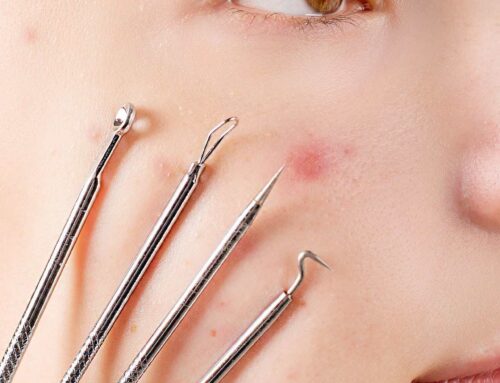 A Beginner’s Guide to Facial Extractions